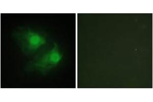 Immunofluorescence analysis of HeLa cells, using LIMK2 Antibody. (LIMK2 anticorps  (AA 461-510))