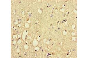 Immunohistochemistry of paraffin-embedded human brain tissue using ABIN7168509 at dilution of 1:100 (RYR2 anticorps  (AA 901-1192))