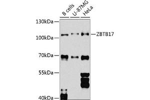 Western blot analysis of extracts of various cell lines, using ZBTB17 Antibody (ABIN6133380, ABIN6150370, ABIN6150371 and ABIN6224531) at 1:1000 dilution. (ZBTB17 anticorps  (AA 121-360))