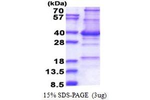 SDS-PAGE (SDS) image for Centromere Protein P (CENPP) (AA 1-288) protein (His tag) (ABIN5853397)