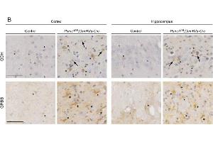 Increased GDH and GPBB in Psmc1fl/fl,CaMKIIα-Cre forebrain.
