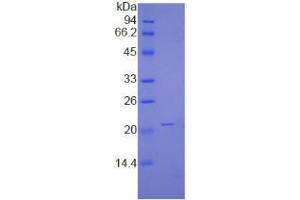 SDS-PAGE analysis of Human NME1 Protein. (NME1 Protéine)