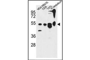Western blot analysis of KIAA0652 Antibody (N-term) in MDA-MB435, CEM, 47D cell line and mouse cerebellum tissue lysates (35ug/lane). (ATG13 anticorps  (N-Term))