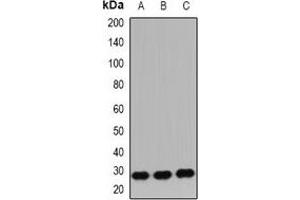 Western blot analysis of IGF2 expression in HepG2 (A), SW480 (B), mouse brain (C) whole cell lysates. (IGF2 anticorps)