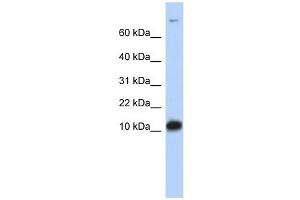 FABP3 antibody used at 1 ug/ml to detect target protein. (FABP3 anticorps)