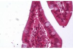 Anti-ACAT1 antibody IHC staining of human small intestine. (ACAT1 anticorps)