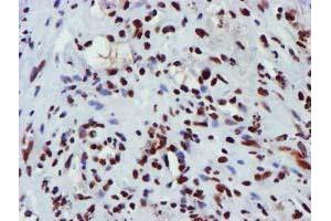 Image no. 11 for anti-Glutathione S-Transferase theta 2 (GSTT2) antibody (ABIN1498553) (GSTT2 anticorps)