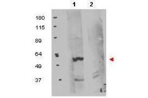 Western blot using  protein A purified anti-FKBP8 antibody shows detection of exogenous FKBP8 in 50 µg of HEK293T whole cell lysate (lane 1). (FKBP8 anticorps  (Internal Region))