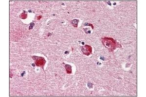 Immunohistochemistry (IHC) image for anti-Protein Phosphatase 1, Catalytic Subunit, alpha Isoform (PPP1CA) (AA 30-299) antibody (ABIN238369) (PPP1CA anticorps  (AA 30-299))