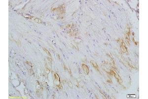Formalin-fixed and paraffin embedded smooth muscle of rat colon labeled with Anti CTHRC1 Polyclonal Antibody, Unconjugated  at 1:200 followed by conjugation to the secondary antibody and DAB staining (CTHRC1 anticorps  (AA 31-130))