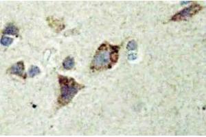 Immunohistochemistry (IHC) analyzes of Rsk-4 antibody in paraffin-embedded human brain tissue. (RPS6KA6 anticorps)