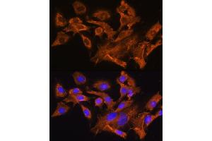 Immunofluorescence analysis of C6 cells using A Rabbit pAb (ABIN6129944, ABIN6137377, ABIN6137378 and ABIN6224448) at dilution of 1:100. (AVPR1A anticorps  (AA 349-418))