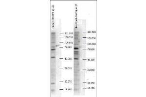 Western blot analysis is shown using  Affinity Purified anti-SH3BP2 pS427 antibody to detect endogenous protein present in unstimulated human whole cell lysates).