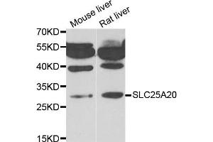Western blot analysis of extracts of mouse liver and rat liver cell lines, using SLC25A20 antibody. (SLC25A20 anticorps)