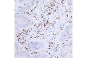 Immunohistochemistry (IHC) image for anti-HLA-DR-gamma (CD74) antibody (ABIN7449435)