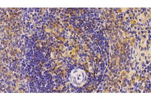 Detection of IL6 in Rat Spleen Tissue using Polyclonal Antibody to Interleukin 6 (IL6) (IL-6 anticorps  (AA 21-211))