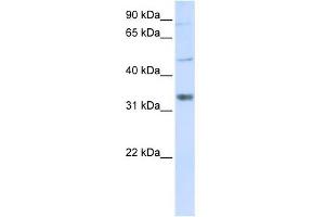 ZCCHC17 antibody used at 1 ug/ml to detect target protein. (ZCCHC17 anticorps  (Middle Region))