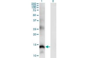 Western Blot analysis of SLPI expression in transfected 293T cell line by SLPI monoclonal antibody (M01), clone 3C6. (SLPI anticorps  (AA 33-132))