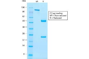 SDS-PAGE Analysis Purified NKX2. (Recombinant Nkx2-2 anticorps)