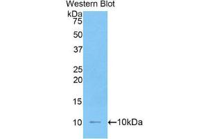 Western Blotting (WB) image for anti-Interleukin 6 Receptor (IL6R) (AA 19-10) antibody (ABIN2120229) (IL-6 Receptor anticorps  (AA 19-10))