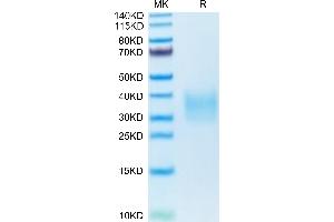 TNFRSF10B Protein (AA 53-180) (His tag)