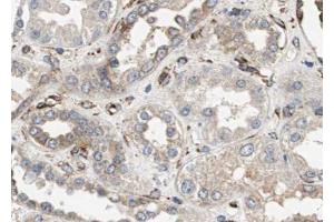ABIN6272853 at 1/100 staining human kidney tissue sections by IHC-P. (GADD34 anticorps)