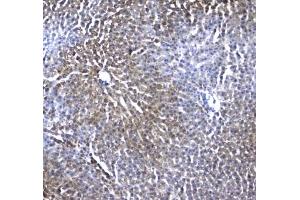 IHC testing of FFPE rat liver tissue with IRF7 antibody at 1ug/ml.