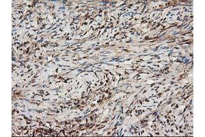 Image no. 3 for anti-NudE Nuclear Distribution E Homolog (A. Nidulans)-Like 1 (NDEL1) antibody (ABIN1499853)