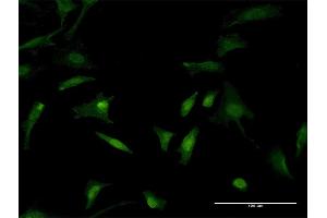 Immunofluorescence of monoclonal antibody to TLN1 on HeLa cell.