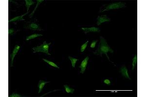 Immunofluorescence of monoclonal antibody to TLN1 on HeLa cell. (TLN1 anticorps  (AA 1324-1424))