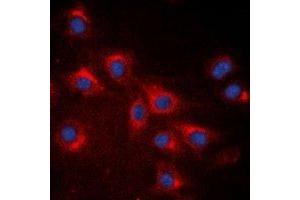 Immunofluorescent analysis of RPS20 staining in A549 cells. (RPS20 anticorps)