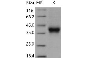 Western Blotting (WB) image for Fc Fragment of IgG, Low Affinity IIb, Receptor (CD32) (FCGR2B) (Active) protein (Biotin,His-Avi Tag) (ABIN7320426)