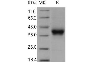 Western Blotting (WB) image for Fc Fragment of IgG, Low Affinity IIb, Receptor (CD32) (FCGR2B) (Active) protein (Biotin,His-Avi Tag) (ABIN7320426) (FCGR2B Protein (Biotin,His-Avi Tag))
