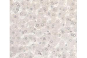 IHC-P analysis of Rat Liver Tissue, with DAB staining. (Androgen Receptor anticorps  (AA 491-679))