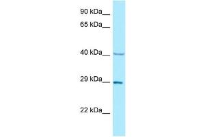 WB Suggested Anti-NCK1 Antibody Titration: 1. (NCK1 anticorps  (N-Term))