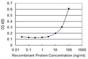 anti-Cystatin A (Stefin A) (CSTA) (AA 1-98) antibody