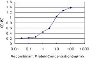 Detection limit for recombinant GST tagged ACADVL is approximately 0.