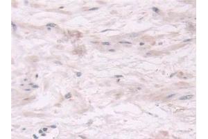 Detection of TPMT in Human Prostate Tissue using Polyclonal Antibody to Thiopurine Methyltransferase (TPMT)