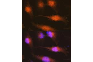 Immunofluorescence analysis of U-251 MG cells using Huntingtin Rabbit pAb (ABIN7267794) at dilution of 1:100 (40x lens).