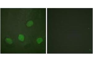 Immunofluorescence analysis of HeLa cells, using CREB (Phospho-Ser142) Antibody. (CREB1 anticorps  (pSer142))