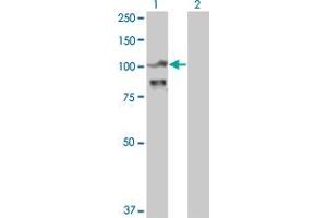 Western Blot analysis of ACTN4 expression in transfected 293T cell line by ACTN4 monoclonal antibody (M01), clone 4D10.