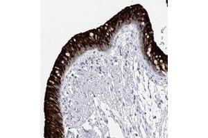 Immunohistochemical staining of human bronchus with RSHL3 polyclonal antibody  shows strong cytoplasmic and membranous positivity in respiratory epithelial cells. (RSPH4A anticorps)