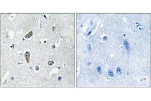 Immunohistochemistry analysis of paraffin-embedded human brain, using CDK5RAP2 Antibody. (CDK5RAP2 anticorps  (AA 251-300))