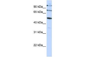WB Suggested Anti-FBXO5 Antibody Titration:  0. (FBXO5 anticorps  (C-Term))