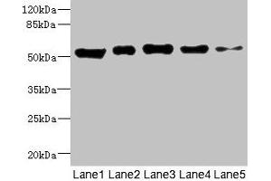 Western blot All lanes: GIPR antibody at 5. (GIPR anticorps  (AA 22-138))