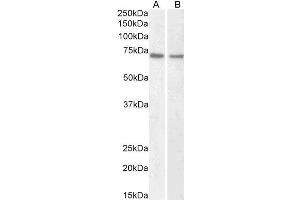 ABIN5539551 (1µg/ml) staining of HeLa (A) and Jurkat (B) nuclear lysate (35µg protein in RIPA buffer). (Lamin B1 anticorps  (AA 526-537))