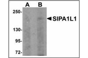 Western blot analysis of SIPA1L1 in rat brain tissue lysate with SIPA1L1 antibody at (A) 0. (SIPA1L1 anticorps  (N-Term))