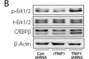 TNIP1 modulates the proliferation of keratinocytes by targeting Erk1/2 and C/EBPβ. (CEBPB anticorps  (N-Term))