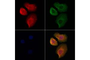 ABIN6262153 and ABIN6278025 staining Hela cells by IF/ICC.