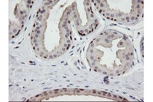 Image no. 4 for anti-Chromosome 2 Open Reading Frame 62 (C2orf62) antibody (ABIN1497053) (C2orf62 anticorps)